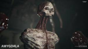AMYGDALA